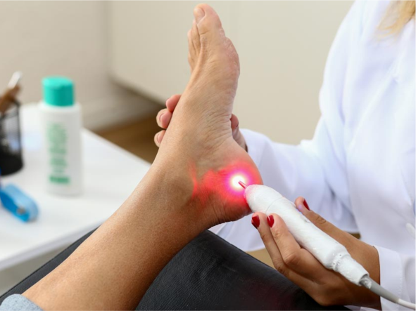 Reflexoterapia com laser